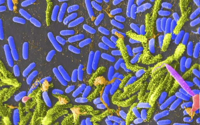 Archivo -  Bacteria Vibrio (Azul) Puede Causar Cólera En Humanos.