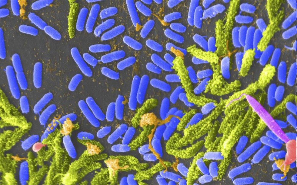 Archivo - Bacteria Vibrio (Azul) Puede Causar Cólera En Humanos.