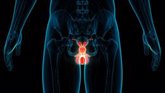 Foto: El cáncer de próstata 'secuestra' el biorritmo de las células tumorales para evadir la terapia hormonal