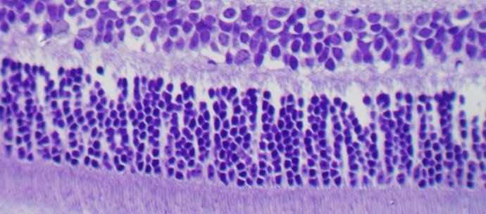 Imagen histológica de retina de ratón pigmentado en la que se distinguen todas las capas, desde el coroides (abajo, lleno de melanocitos) al inmediato epitelio pigmentado de la retina y acabando (arriba de todo) con las células ganglionares.