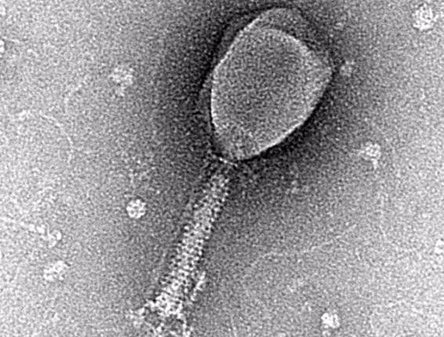 Micrografía del fago T2 de enterobacteria, un bacteriófago de cola. /
