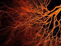 Estas son las 7 sencillas recomendaciones para evitar la enfermedad vascular