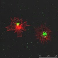 Investigadores nacionales e internacionales debaten en la VII Edición de HIBIC las principales novedades en VIH