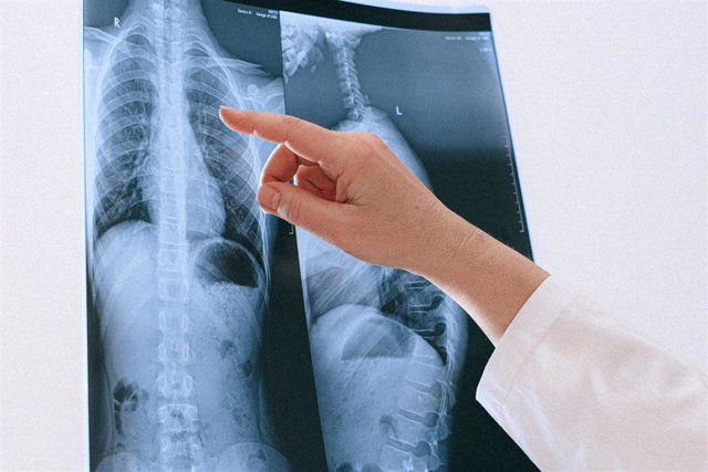 Radiografía de pulmón.