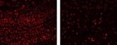 Foto: Investigadores españoles hallan las células matan las neuronas en un modelo animal de enfermedad mitocondrial