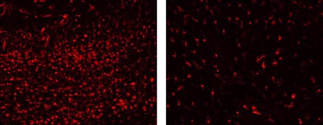 Investigadores españoles hallan las células matan las neuronas en un modelo animal de enfermedad mitocondrial