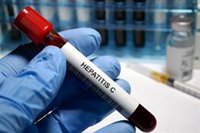 El acceso al tratamiento de la hepatitis C reduce la morbilidad y la mortalidad en las personas que se inyectan drogas