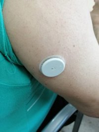 El Distrito Córdoba y Guadalquivir implanta el sistema de monitorización continua de glucosa a 76 usuarios