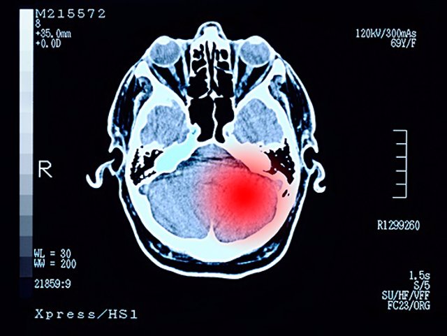 Archivo - Un estudio en 2.002 tumores identifica 11 subtipos moleculares en 14 tipos de cáncer