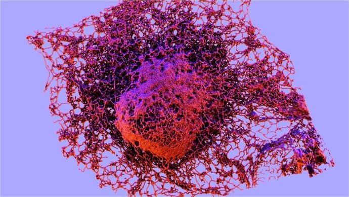Archivo - Esta imagen muestra la distribución celular del retículo endoplásmico (en rojo) en las células cancerosas.