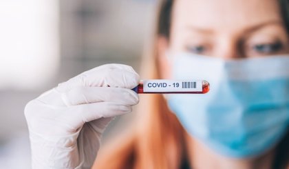 Cvirus.- Sanidad notifica 72.704 nuevos casos de coronavirus, 34.342 en  mayores de 60 años