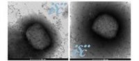 El CIBERINFEC impulsa un proyecto para evaluar el impacto clínico y microbiológico de la viruela del mono