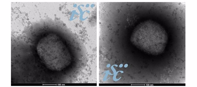 Dos imágenes, obtenidas por microscopía electrónica, del virus de la viruela del mono. Imagen: Unidad de Microscopía Electrónica del ISCIII