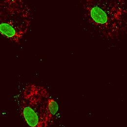 Células de sangre humana después de la reducción de la expresión del gen DNMT3A. Los núcleos celulares (grandes estructuras verdes) dentro de la proteína citoplasmática (roja).