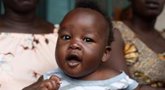 Foto: La OMS avisa de que el mundo se enfrenta a un brote de hepatitis "de origen desconocido" que afecta a los niños