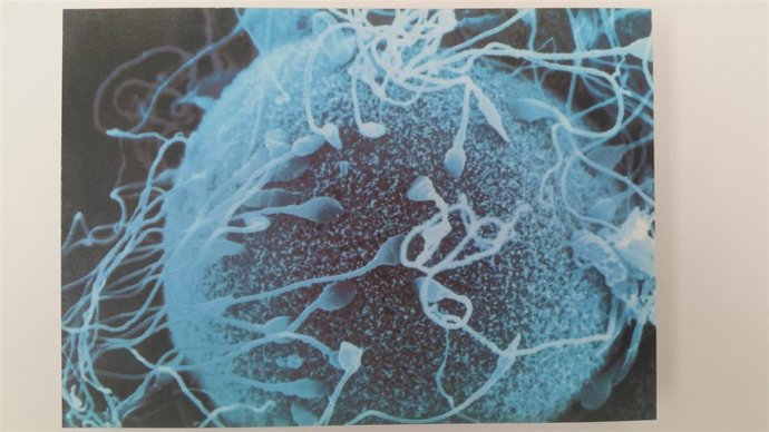 Archivo - Espermatozoide en la superficie del óvulo 