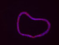 Identifican nuevos marcadores de riesgo del cáncer de colon y la colitis ulcerosa
