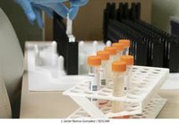 Bajan a 334 los casos activos de viruela del mono en Andalucía, con 94 más en investigación