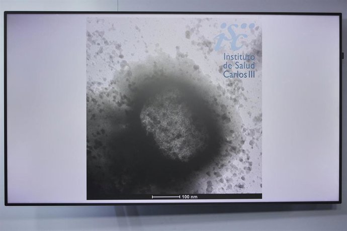 Archivo - Una molécula de la viruela del mono como resultado de un estudio de la universidad Carlos III.