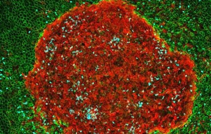 Archivo - Imagen de un agregado multicelular en la cavidad peritoneal tras 4 horas de infección con E. Coli (macrófagos en rojo, neutrófilos en azul y células mesoteliales en verde).