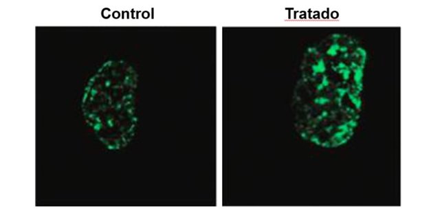 Los niveles de algunas marcas epigenéticas como H3K9me3 disminuyen con la edad causando la pérdida de heterocromatina (Control, verde). El bloqueo del ARN LINE-1 mediante el tratamiento con oligos antisentido restaura los niveles de H3K9me3 en las células