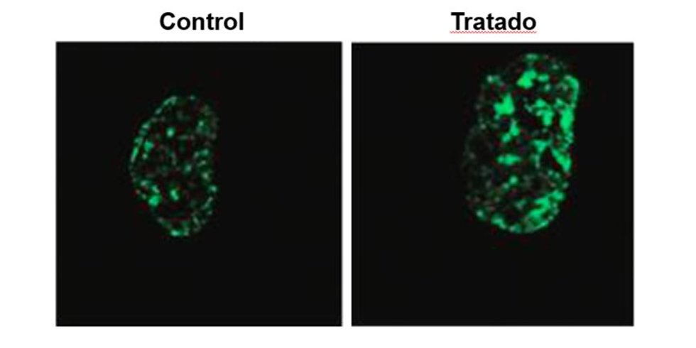 Los niveles de algunas marcas epigenéticas como H3K9me3 disminuyen con la edad causando la pérdida de heterocromatina (Control, verde). El bloqueo del ARN LINE-1 mediante el tratamiento con oligos antisentido restaura los niveles de H3K9me3 en las célul