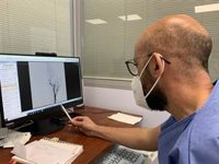 Andalucía mejora la atención al ictus y sitúa la tasa de trombectomías por encima de la media nacional