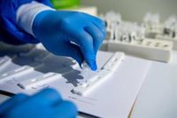 Andalucía baja a 334 hospitalizados por Covid, suma 1.579 casos y 35 muertes, y la tasa en mayores de 60 desciende a 133