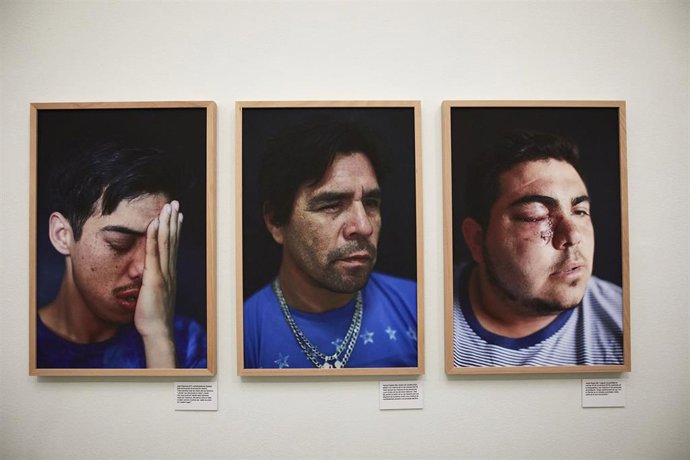 Archivo - Algunas de las imágenes que forman parte de la Exposición del 24 Premio Internacional de Fotografía Humanitaria Luis Valtueña que se exponen en la Real Academia de Bellas Artes de San Fernando hasta el próximo 18 de abril, en Madrid (España),