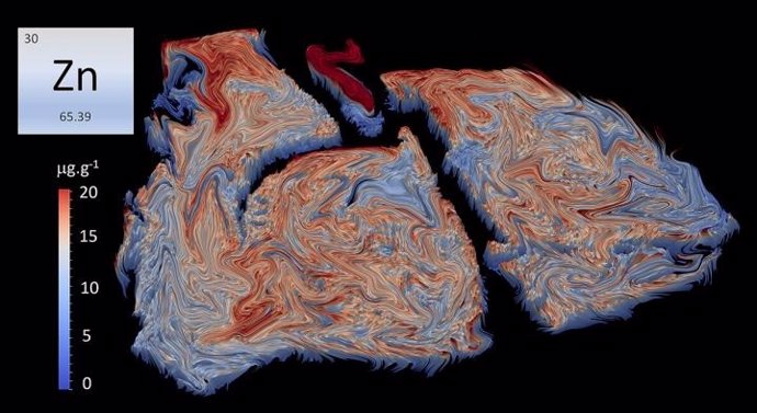 Archivo - Estas son bioimágenes elementales de pulmones de ratón durante la infección por Streptococcus pneumoniae . La imagen muestra niveles elevados de zinc (regiones naranja a rojo) movilizados por la respuesta inmune innata a los sitios donde la ba