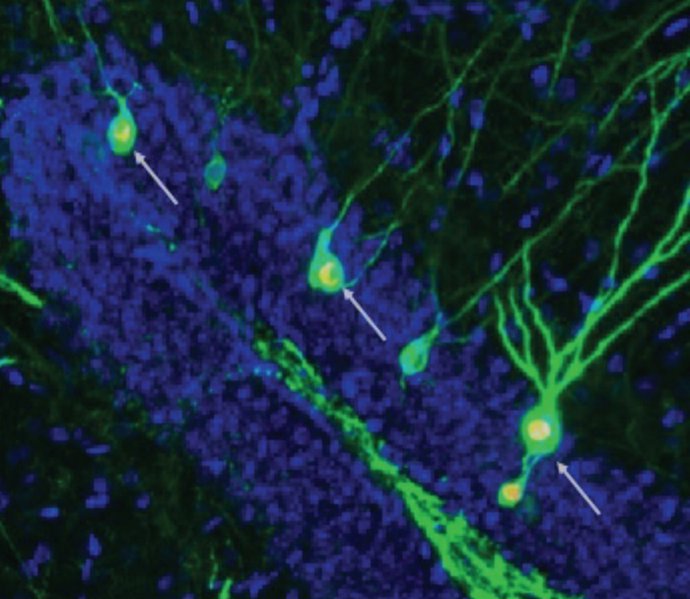 Neuronas de almacenamiento de memoria en el hipocampo de ratones con Alzheimer.