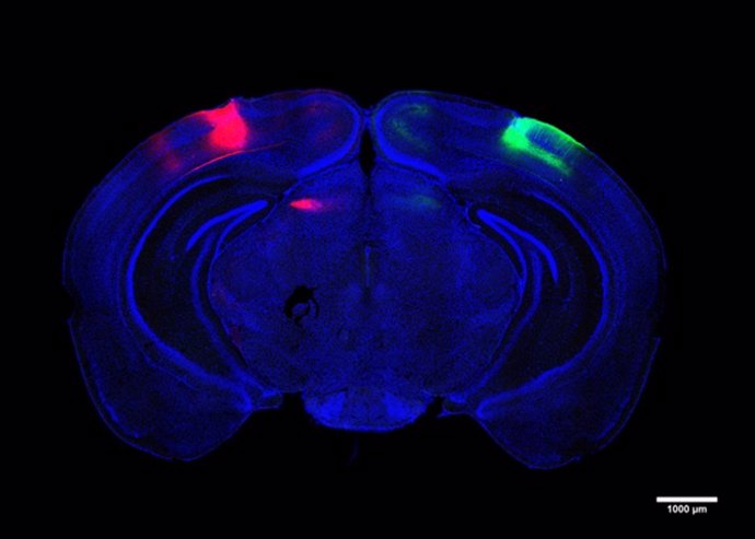 Los científicos rastrearon y estudiaron las neuronas que conectan las cortezas visuales en cada hemisferio del cerebro.