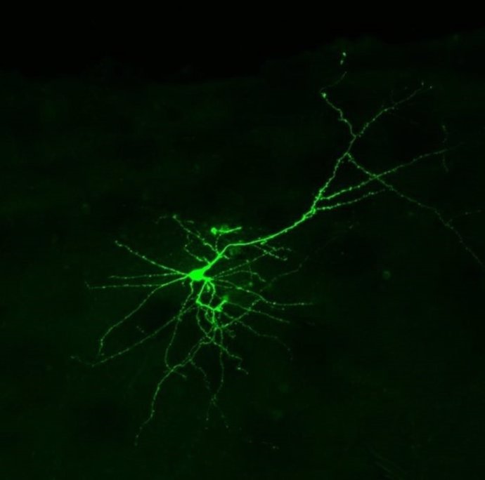 Una neurona cultivada vista bajo un microscopio de fluorescencia.
