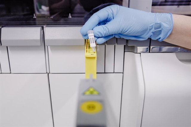 Archivo - Una técnico de laboratorio extrae el material genético del virus de la viruela del mono, en el Hospital Ramón y Cajal
