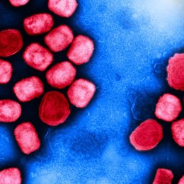 Micrografía electrónica de transmisión coloreada de partículas del virus de la viruela del mono (rojo) cultivadas y purificadas a partir de un cultivo celular.