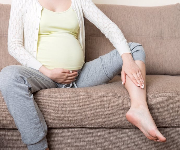 Embarazada y varices