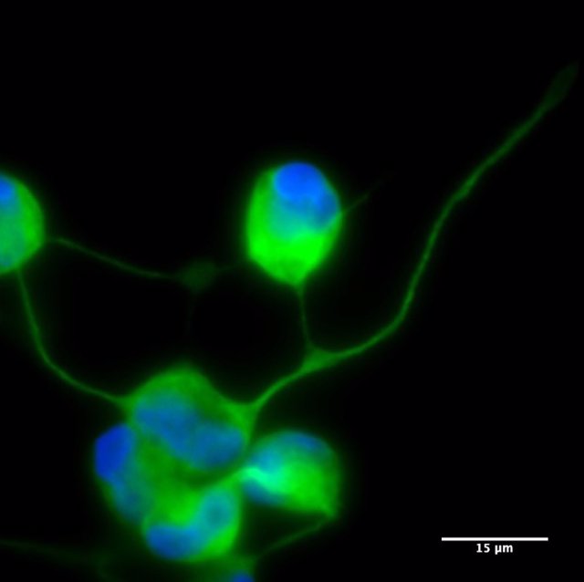 Neuronas a partir de la reprogramación directa de celúlas de pacientes mitocondriales con síndrome Melas.