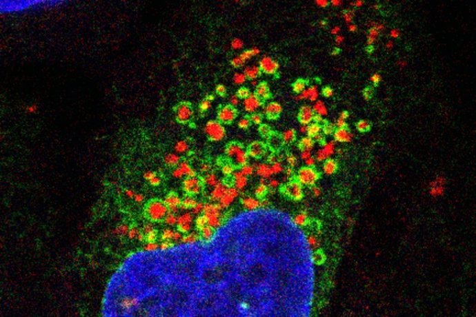 Imágenes de microscopía de fluorescencia que muestran la red de retículo endoplásmico (verde) que envuelve los lisosomas dañados (rojo). El núcleo celular se muestra en azul.