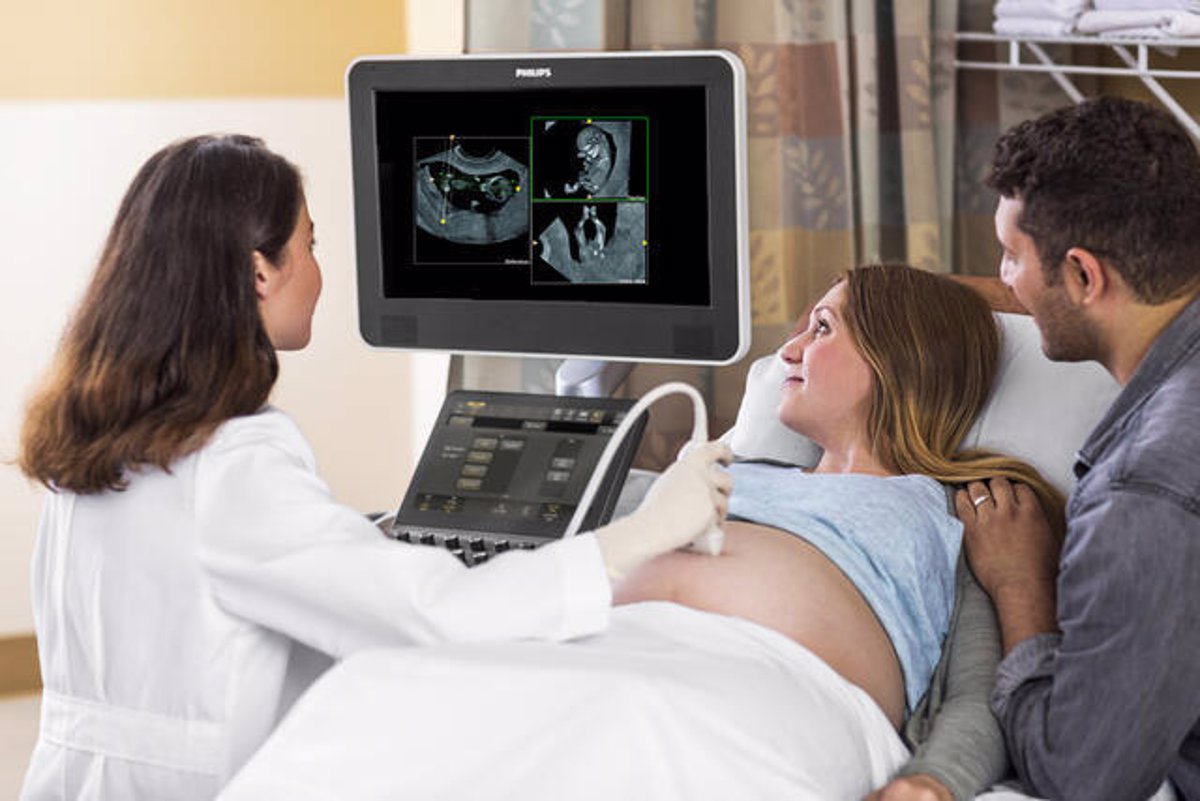 Philips Presenta El Software Fetview Para Ecografía De Obstetricia Y Ginecología 0128