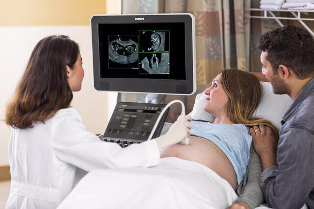 Software de intercambio de imágenes e informes FetView para ecografía de obstetricia y ginecología
