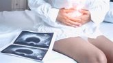 Foto: Un estudio propone un nuevo criterio para el síndrome de ovario poliquístico que permite un tratamiento más preciso