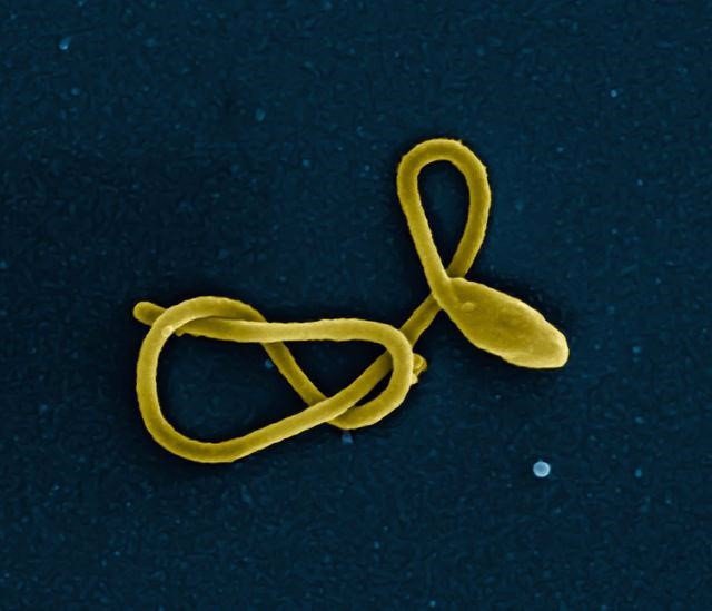 Archivo - Partícula del virus del Ébola
