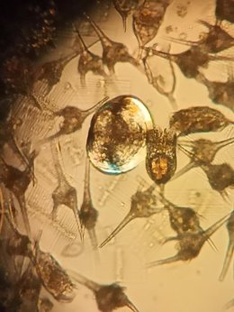 Larvas de mejillón cebra ampliadas a microscopio