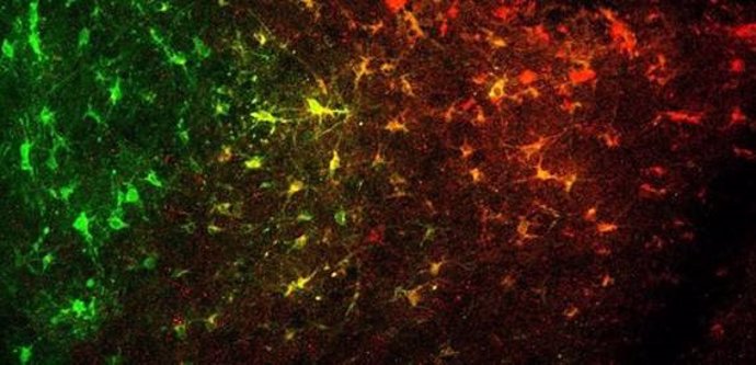 Redes astrocito-neurona en el núcleo accumbens.