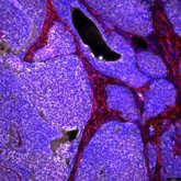 Foto: Investigadores del CSIC crean nanopartículas que mejoran terapias oncológicas y disminuyen su toxicidad