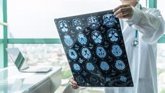 Foto: Un fármaco en investigación frena un 27% el deterioro cognitivo en personas con Alzheimer