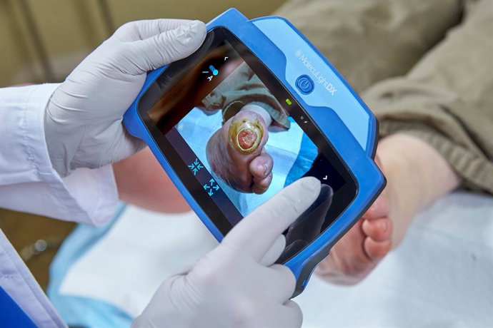 MolecuLightDX point-of-care imaging system for detection of elevated bacterial loads in wounds and for performing digital wound measurement and tracking
