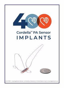 Endotronix celebrates the 400th worldwide implant of the Cordella Pulmonary Artery Pressure Sensor.