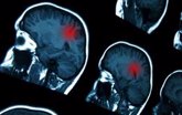 Foto: Un estudio revela la principal diana de la COVID-19 en el cerebro y describe sus efectos en el sistema nervioso