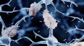Foto: Nuevos datos apuntan a esta proteína, y no a las placas amiloides, como causa del desarrollo del Alzheimer